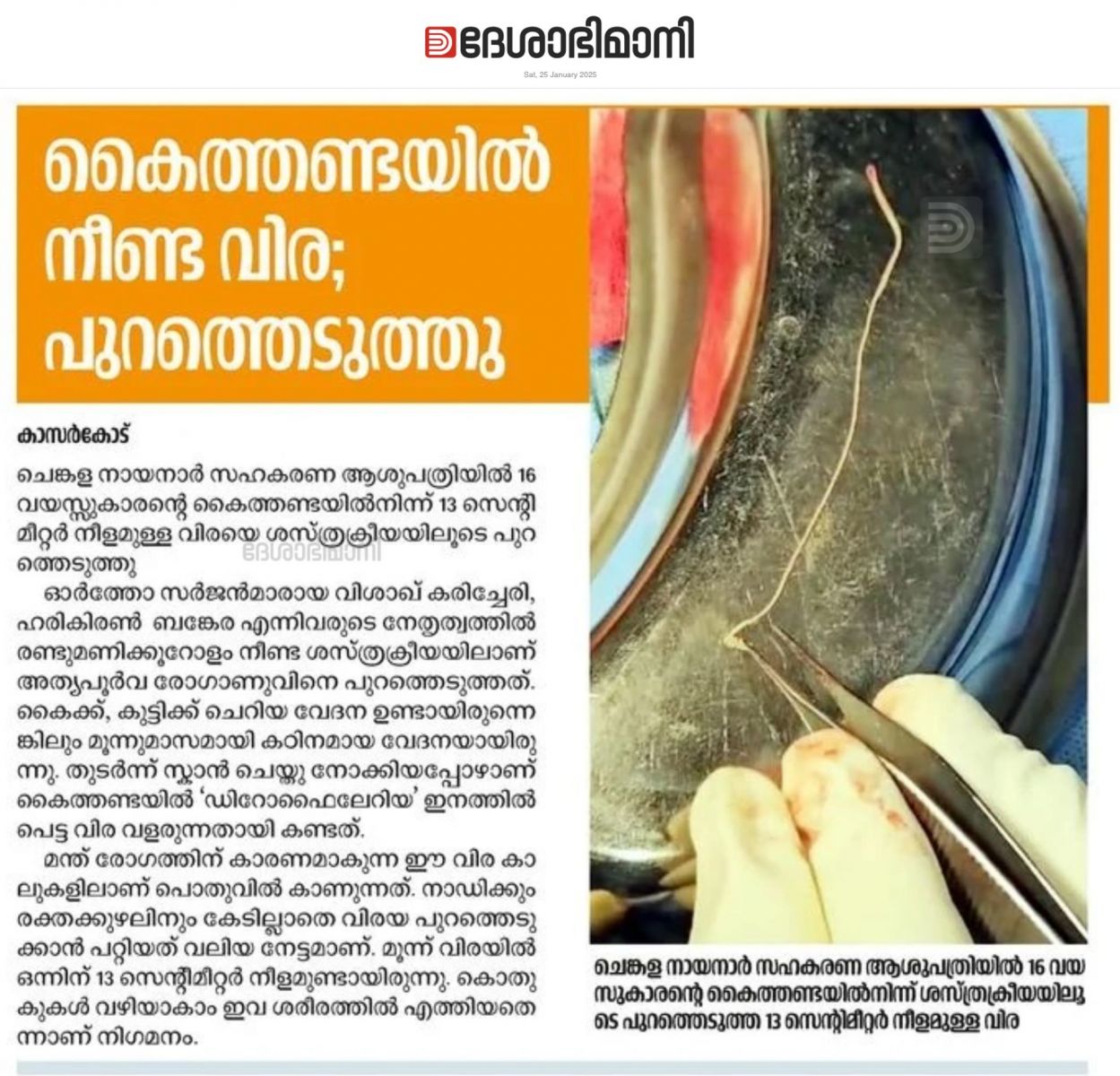 EKN PROCEDURE
